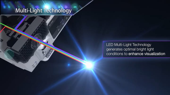 Investiție de 150.000 de euro la Spitalul Județean Reșița: Pacienții din Caraș Severin vor beneficia de endoscopie digestivă de ultimă generație